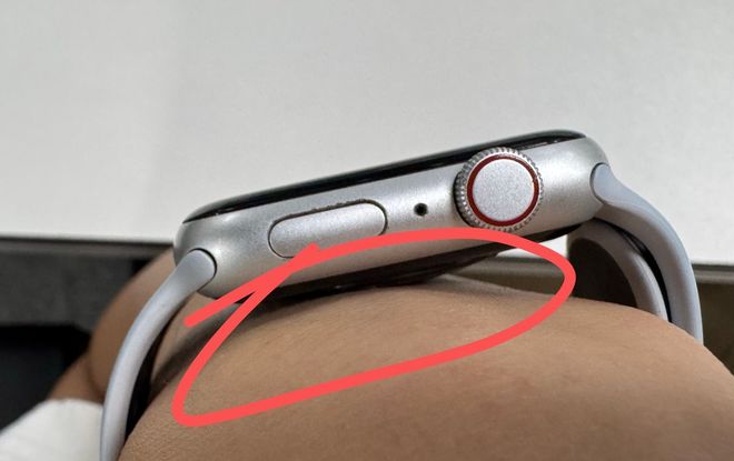 要选对材质佩戴方式也很重要智能手表导致皮肤红肿？不光(图2)