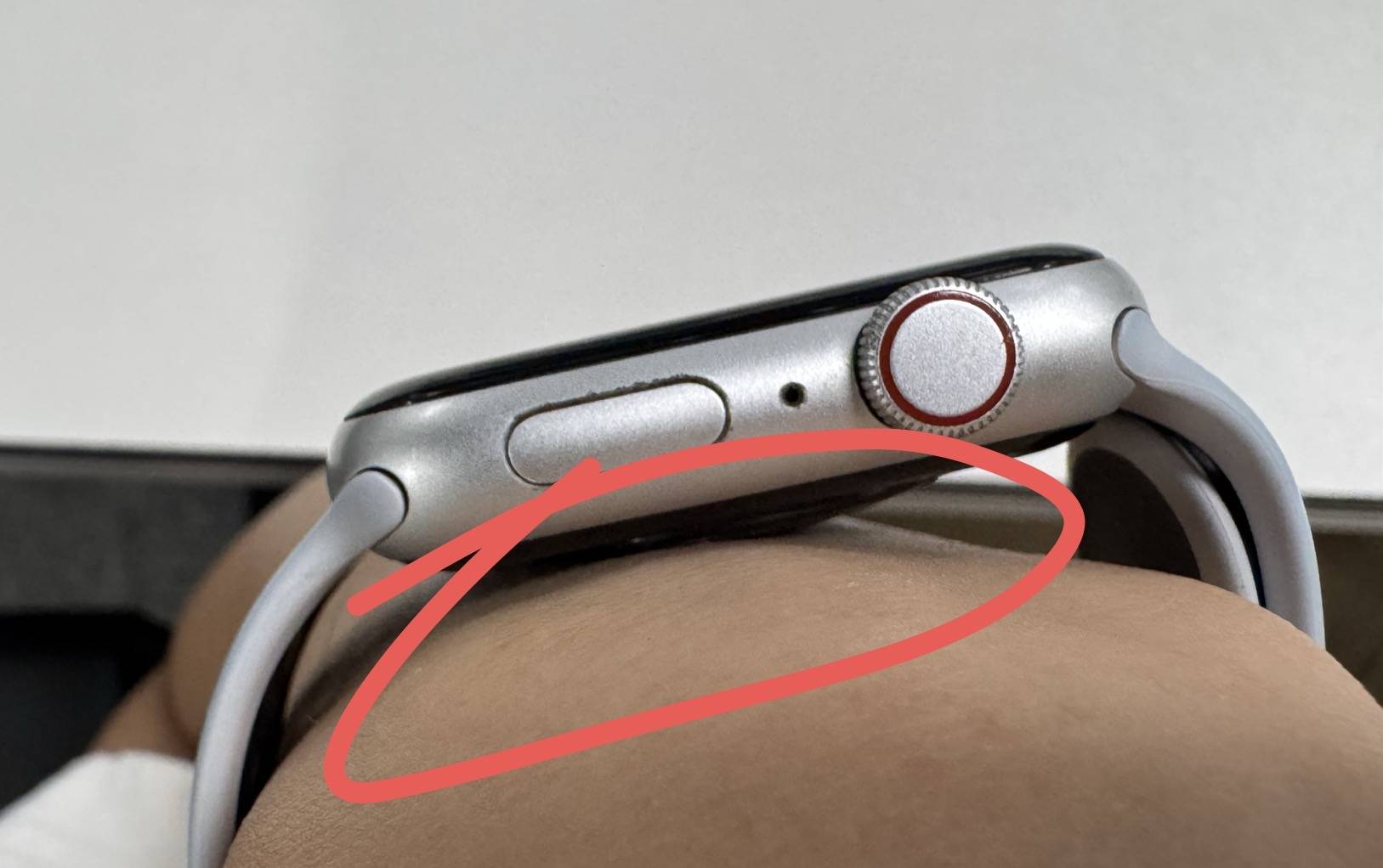 材质问题还是佩戴方式不对?三星手表再曝过敏事件!是(图4) 材质问题还是佩戴方式不对?三星手表再曝过敏事件!是(图4)